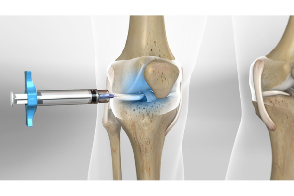 Knee & Hip Replacement 